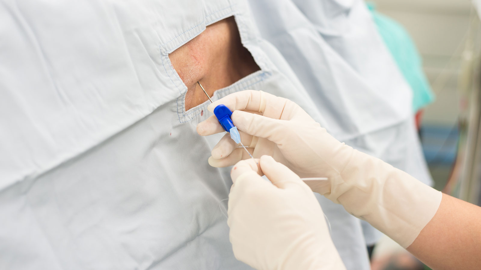 37η εβδομάδα εγκυμοσύνης